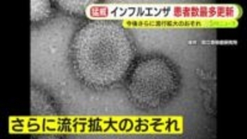 インフルエンザB型が静岡県内で猛威　患者数は今シーズン最多を更新…今後さらに感染拡大のおそれ