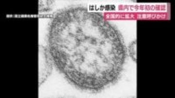 静岡県内で今年初の“はしか”感染を確認　全国的に拡大傾向にあり注意呼びかけ