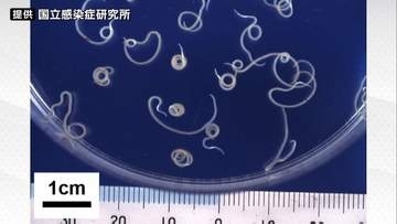 【アニサキス食中毒】仙台市内の居酒屋で"カツオのたたき"が入ったサラダを食べた女性が腹痛などを訴える　店は1日間、生鮮魚介類の生食用調理と提供を停止の処分を受ける
