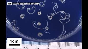 【アニサキス食中毒】イワシの寿司など食べた客が腹痛 寿司店を1日の一部営業停止　宮城・石巻市