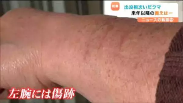 「熊と聞くだけで恐怖」左腕に残る引っかき傷 襲われた女性が語る後遺症「破傷風の注射、安定剤も飲んでいる」次の大量出没は2年後？