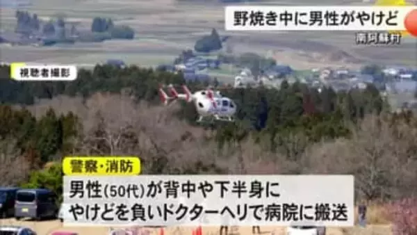 南阿蘇村で野焼きをしていた男性がやけどを負い病院搬送【熊本】