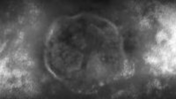 『はしか』の感染力はインフルの10倍「最強クラス」　「今、ワクチン供給量は十分」必要であれば大人も接種を　福岡でも今年初の感染者