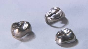 まだ上がる↗そろそろ↘ 貴金属の価格高騰の影響 『儲かる人』の裏に『困る人』の現実【福岡発】