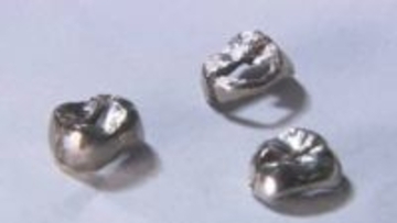 まだ上がる↗そろそろ↘ 貴金属の価格高騰の影響 『儲かる人』の裏に『困る人』の現実【福岡発】