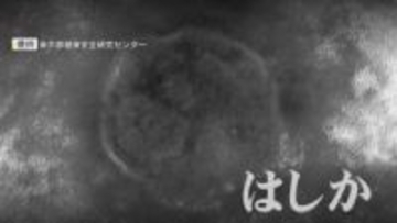 脳炎や肺炎などの合併症を引き起こす恐れ『はしか』 “最強クラス”とされる感染力 成人もワクチン接種を 【福岡発】