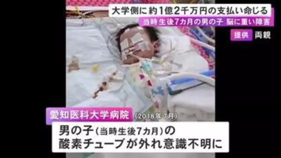 酸素チューブ外れ…入院中の生後7カ月の男の子が重体となり脳に重い障害 大学病院側に約1億2千万円の支払い命じる判決
