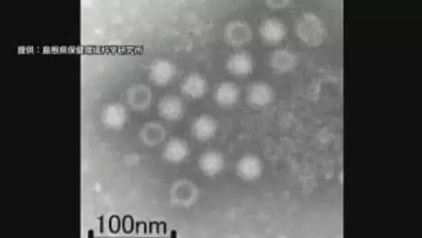 わずかな量でも感染ノロウイルスによる食中毒「アルコール消毒は効果薄」対策の難しさ【2025ピックアップ】