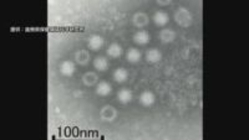 わずかな量でも感染ノロウイルスによる食中毒「アルコール消毒は効果薄」対策の難しさ【2025ピックアップ】