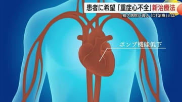 ドナー不足で心臓移植困難「重症心不全」患者に光…DT治療“命つなぐ補助人工心臓”期待と課題（鳥取）