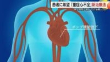 ドナー不足で心臓移植困難「重症心不全」患者に光…DT治療“命つなぐ補助人工心臓”期待と課題（鳥取）