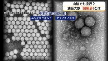 なんとなく風邪っぽい…山陰でも増加「謎風邪」子ども中心に長引く体調不良「油断大敵」早期受診を