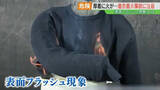 「毛羽立ち多いセーターは注意！数秒で燃え広がる「表面フラッシュ現象」着衣着火の恐ろしさ」の画像1