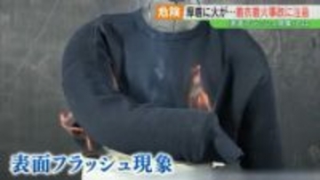 毛羽立ち多いセーターは注意！数秒で燃え広がる「表面フラッシュ現象」着衣着火の恐ろしさ