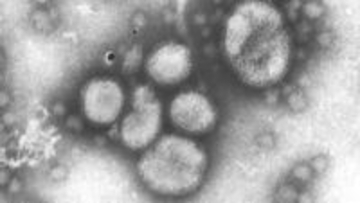 インフルエンザ、2度目の流行　医師に聞く「A型」と「B型」何が違う？