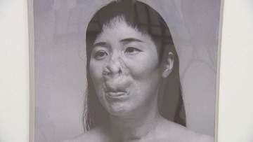 「生身として見てほしい」“見た目問題” に向き合う河除静香さん写真展 40回超の手術を乗り越え　当事者36人のありのまま伝える　23日まで　富山・南砺市