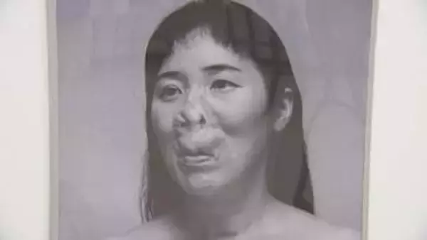 「生身として見てほしい」“見た目問題” に向き合う河除静香さん写真展 40回超の手術を乗り越え　当事者36人のありのまま伝える　23日まで　富山・南砺市