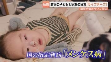 指定難病メンケス病と生きる家族の日常…映画「ライフテープ」安楽涼監督が語る　圧倒的な愛と力強さに満ちた2年間の記録