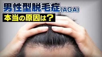 AGAによる薄毛に「男性ホルモンの量」「ストレス」は無関係？本当の原因は “DHT感受性”  「1本の髪から1000本の髪を作る」最新研究も【医師が解説】