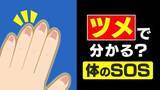 「“爪切りの頻度” が減ったら体からのSOS…？ 飲酒や喫煙など生活習慣も原因に　指先の数ミリの成長が示す「体調の履歴書」メカニズムは？【2025年度 話題の記事】」の画像1