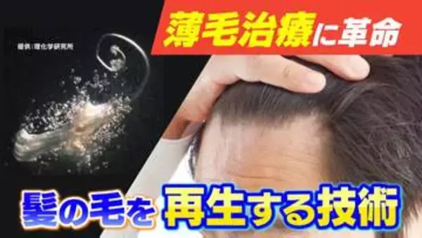 薄毛治療に革命「1本の髪の毛が数百本に」髪の毛を作る “毛包” の再生を支える細胞を発見　再生医療への応用に期待