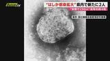 「【はしか感染拡大】全国の感染者累計299人…前年同期比3.8倍にのぼる中で静岡県内でも21日に新たに2人確認」の画像1