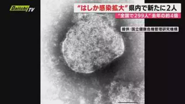 【はしか感染拡大】全国の感染者累計299人…前年同期比3.8倍にのぼる中で静岡県内でも21日に新たに2人確認