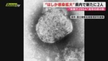 【はしか感染拡大】全国の感染者累計299人…前年同期比3.8倍にのぼる中で静岡県内でも21日に新たに2人確認