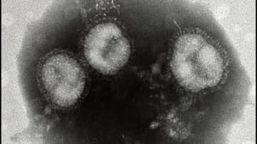 札幌市が「臨時小児ドライブスルー発熱外来」を開設＿12月7日から3月末までの『日祝・年末年始』医師会と連携しインフルエンザや新型コロナの流行に対応＿対象は6歳から15歳の小中学生＜北海道＞