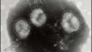 【インフルエンザ警報】札幌市で今シーズン2回目の発令―定点あたり33.45人で基準超え ―手洗い・咳エチケットの徹底を＜北海道＞