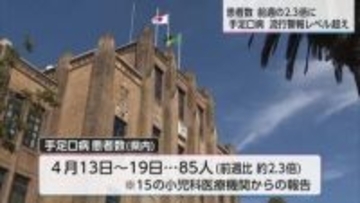 手足口病の患者85人　約8割が1歳から2歳　県内で流行警報レベル超える