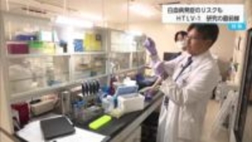 白血病の発症リスクになるウイルス　HTLV−1　研究の最前線