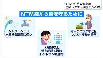 【特集】長引く咳や胸の痛み　「NTM症」患者が増加　症状と対策は