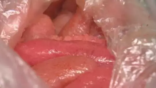 明太子とたらこは物価の優等生？　スケソウダラ漁獲量が安定だけではない理由　一方で「4月ぐらいから値上げする可能性が」