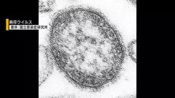 はしかはGWに注意 全国で感染拡大➡県内でも3人が感染 専門家が無料検査呼びかけ 山梨