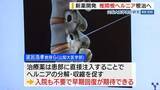「新薬開発 椎間板ヘルニア根治へ 山梨大医学部が研究 「社会的・経済的にも負担が減るのでは」 山梨」の画像1