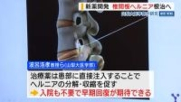 新薬開発 椎間板ヘルニア根治へ 山梨大医学部が研究 「社会的・経済的にも負担が減るのでは」 山梨