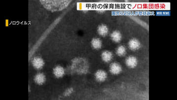 保育施設でノロ集団感染 園児ら29人が症状訴え 県内での集団感染は今季初 山梨・甲府市