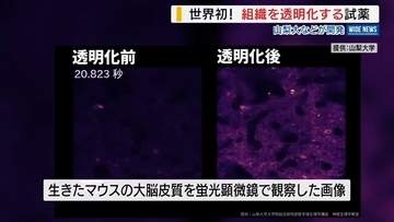 世界初！生きたまま“組織を透明化する”試薬 山梨大などが開発 透明人間は可能？