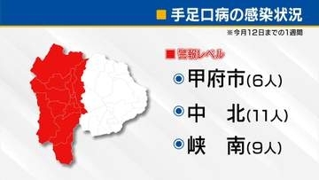 「手足口病」甲府・中北・峡南で警報レベル「水ぼうそう」も中北で6年ぶり警報に 山梨