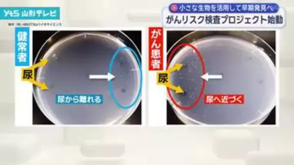 線虫を活用して早期発見へ がんリスク検査プロジェクト始動
