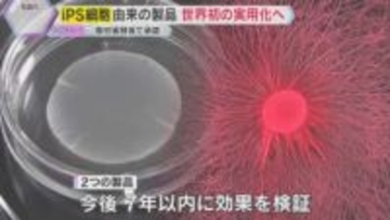iPS細胞による再生医療が世界初の実用化へ　心臓病とパーキンソン病の治療に踏み出す大きな一歩