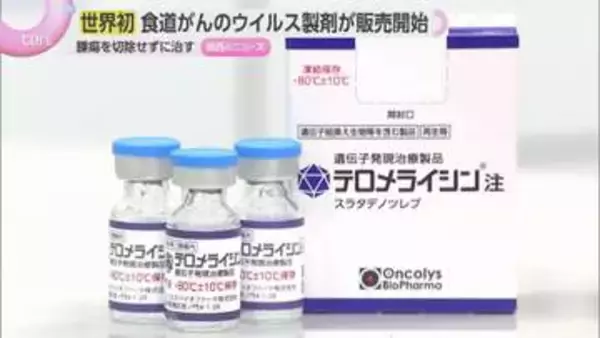 【世界初】食道がんの新薬「テロメライシン注」発売　ウイルスでがん細胞を破壊「切らない治療」へ期待