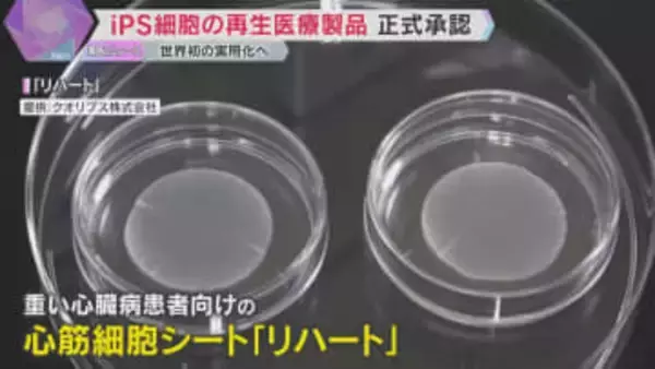 iPS再生医療製品が世界初承認　心臓病とパーキンソン病の新治療が早ければ今年夏にも保険適用へ