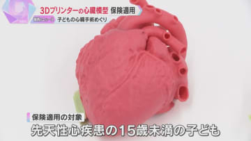 難しい子どもの心臓手術に光　3Dプリンターで作った実物大の模型に保険適用「海外でも使えるように」