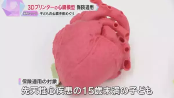 難しい子どもの心臓手術に光　3Dプリンターで作った実物大の模型に保険適用「海外でも使えるように」