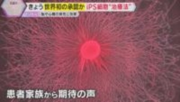 きょう（19日）世界初の承認か　iPS細胞使った再生医療製品実用化へ　パーキンソン病などの治療に