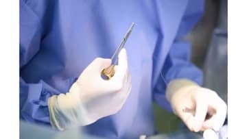 【医療危機】“未来の外科医療”を守るため…大阪大学の小児外科医らがAI外科教育システムのクラウドファンディング