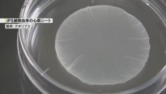 iPS細胞使った心臓病患者のための心筋細胞シート　秋ごろ販売開始へ　大阪大学発のベンチャー企業
