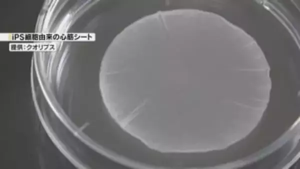 iPS細胞使った心臓病患者のための心筋細胞シート　秋ごろ販売開始へ　大阪大学発のベンチャー企業